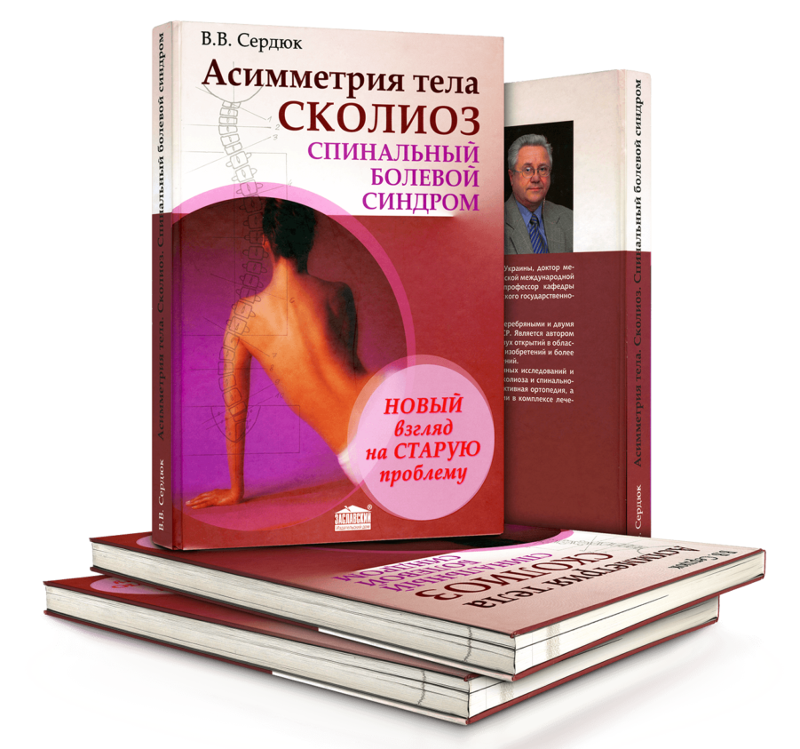 Асимметрия тела. Сколиоз — первое издание