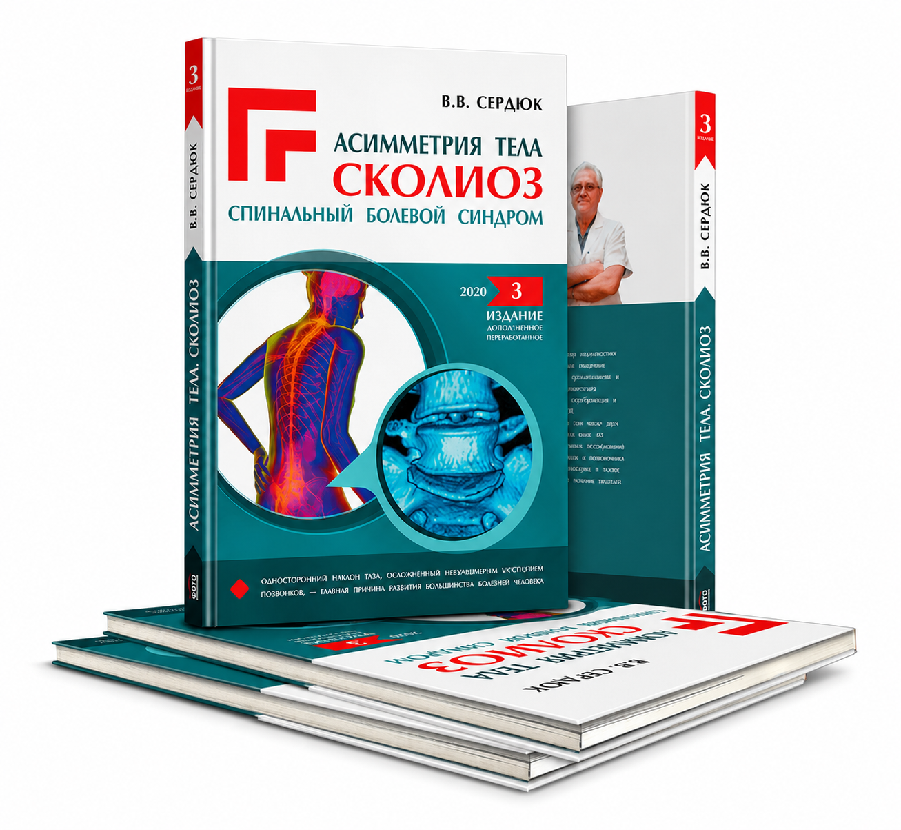 Асиметрія Тіла. Сколіоз — третье издание