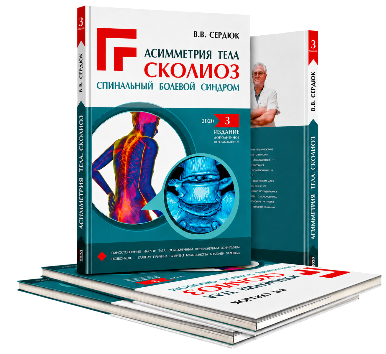 Асимметрия тела. Сколиоз